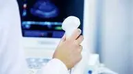افزایش ۳۰ درصدی احتمال بارداری با اصلاح سبک زندگی