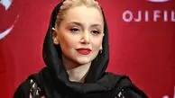 نگاهی به تغییر چهره نازنین بیاتی و شقایق دهقان + عکس