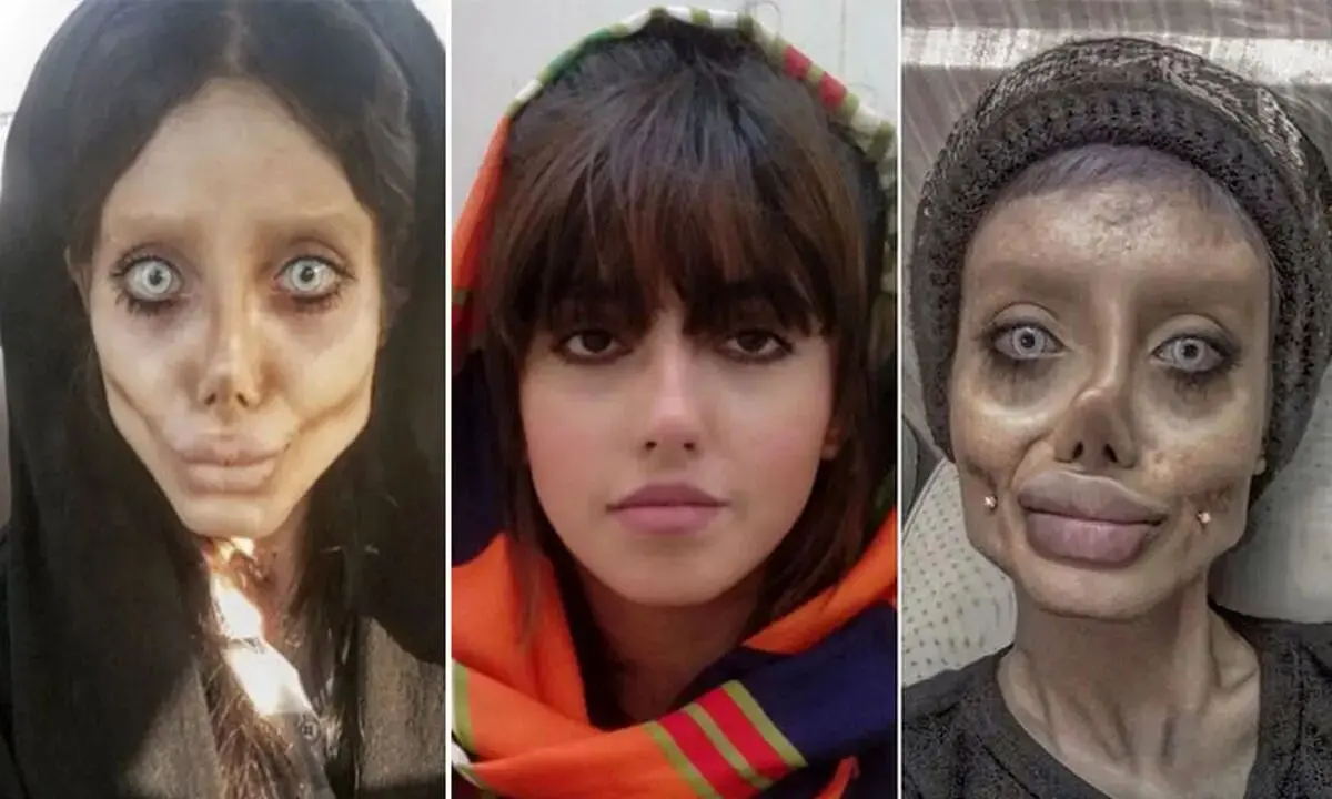 بیوگرافی سحر تبر+ عکس های قبل از عمل