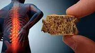 راهکاری طلایی جلوگیری از پوکی استخوان چیست؟