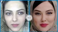 لیلا اوتادی قبل از عمل زیبایی