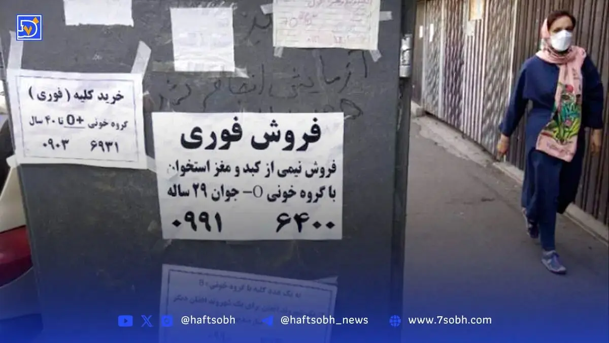 فروش‌ کلیه تا‌ ۷۰ میلیارد‌ تومان