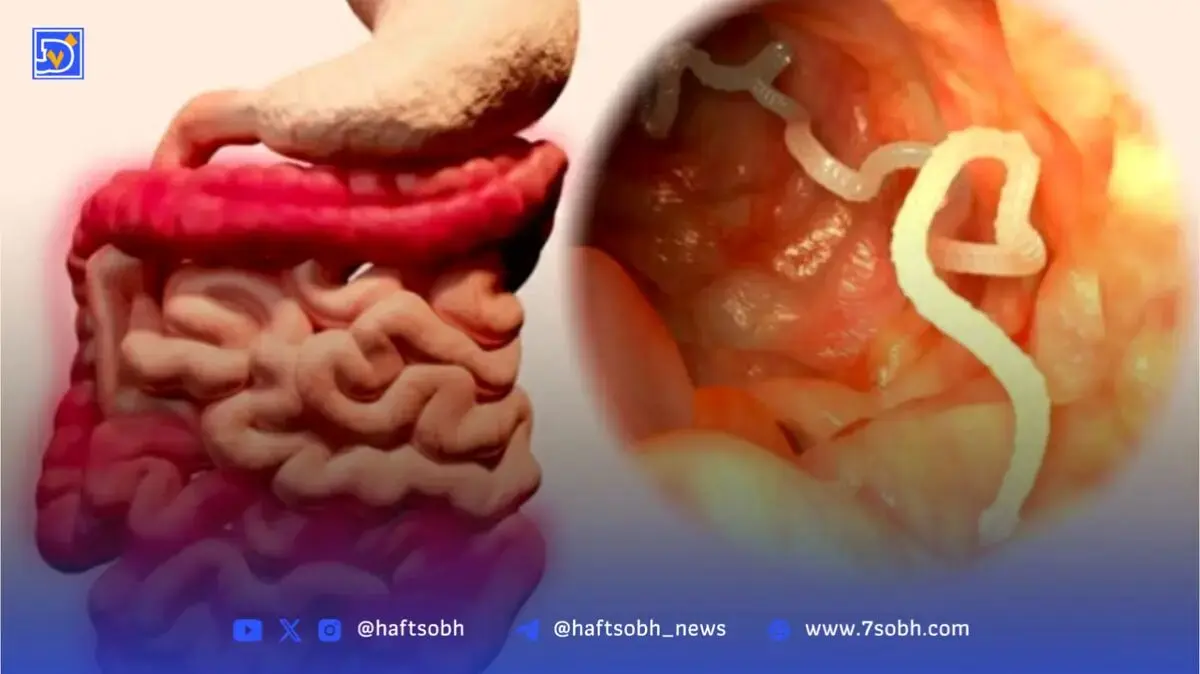 رفع درد با این انگل ترسناک