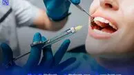 رنگ دندان چه چیزهایی درباره سلامت شما می‌گوید؟