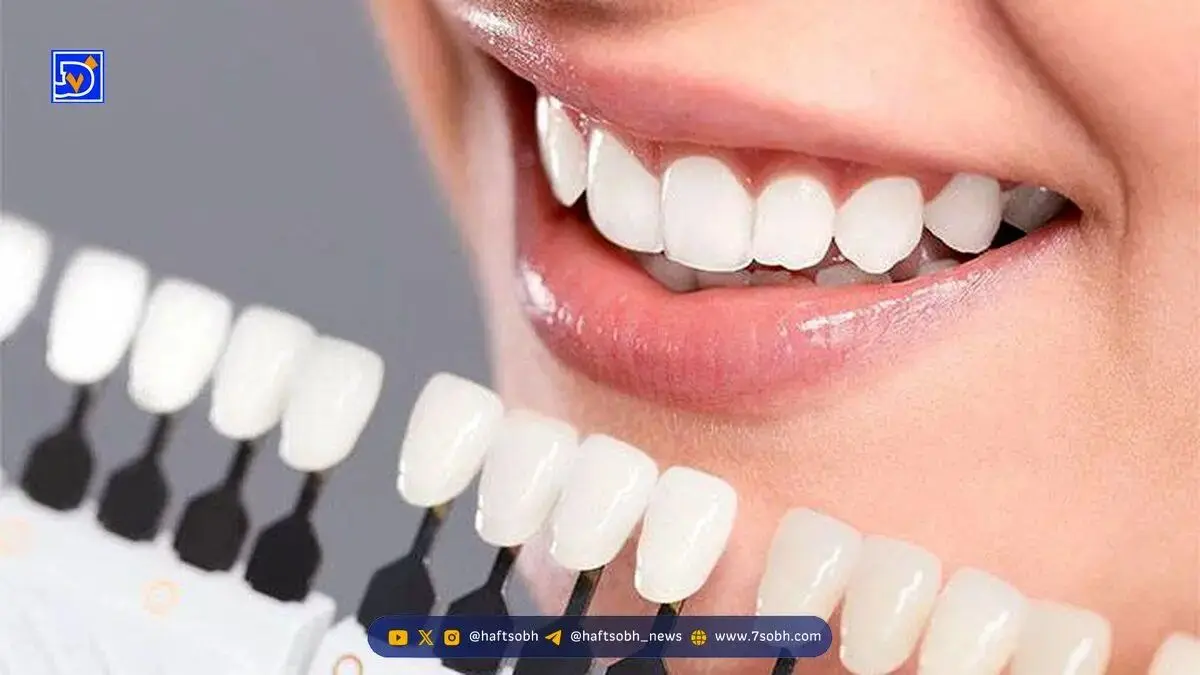 راز داشتن دندان‌های سفید