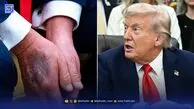 فوری/ ترامپ برای معاینات پزشکی غیرمنتظره فراخوانده شد