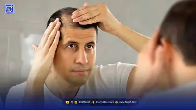 ریزش مو دارید؟ شاید علت چیزی باشد که فکرش را نمی‌کنید