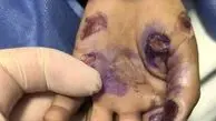 مرگ تلخ کودک 4 ساله بر اثر کودک آزاری