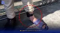 پابند الکترونیکی که نزدیک بود جان بیمار را بگیرد