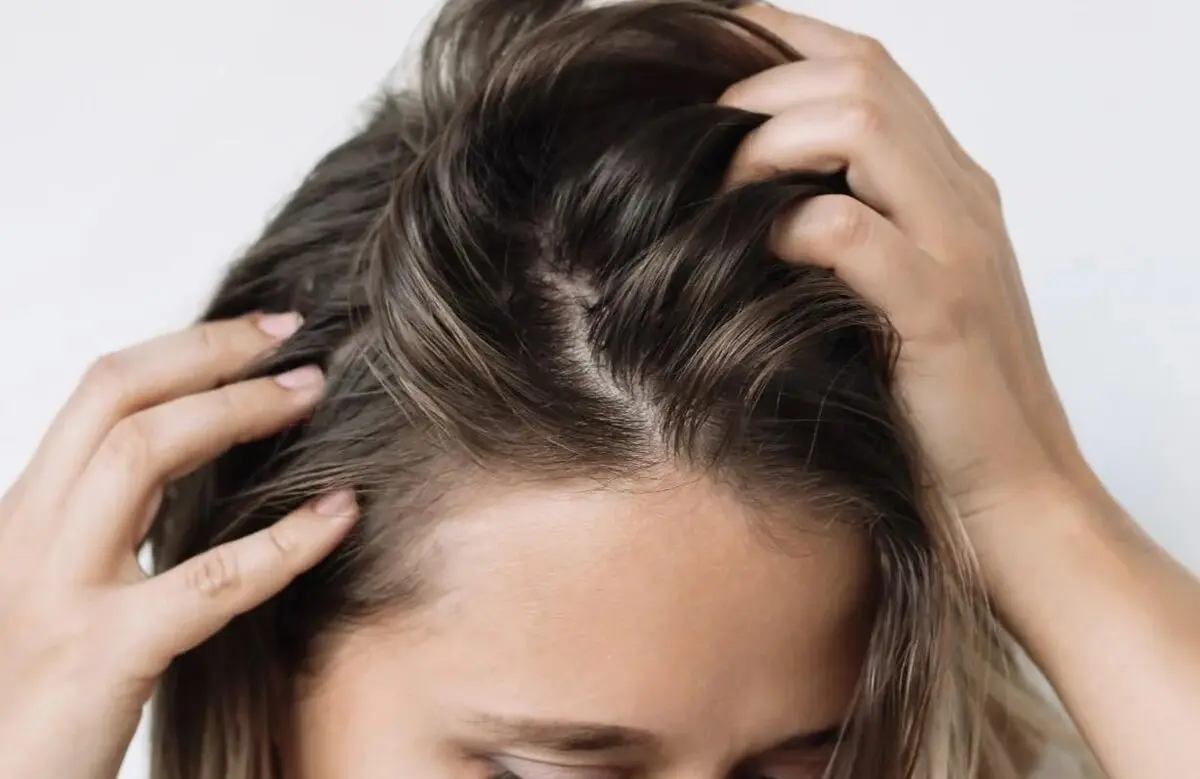چگونه از چرب شدن پوست سر جلوگیری کنیم؟