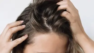 چگونه از چرب شدن پوست سر جلوگیری کنیم؟