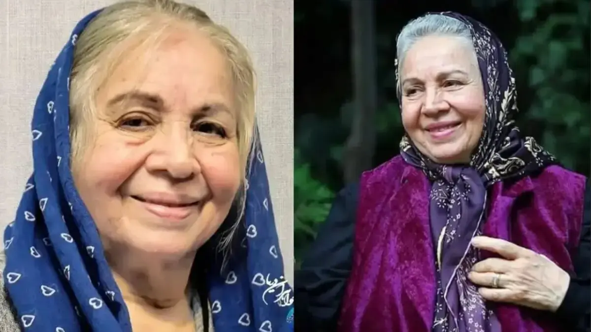 تغییر چهره شمسی فضل‌اللهی بازیگر سریال سه در چهار بعد از گذشت ۱۷ سال