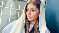 عکس| تغییر چهره زهرا مددی بازیگر نقش شکوفه سریال وحشی خارج از فیلم
