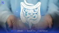 دلایل ابتلا به سرطان روده چیست؟ / راه‌های پیشگیری از این بیماری کشنده