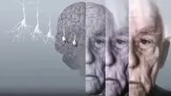۷ عادت مفید در پیشگیری از آلزایمر