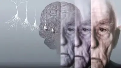 ۷ عادت مفید در پیشگیری از آلزایمر