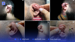 چند می‌گیری گوش بشکنی؟ | درباره پدیده عجیب شکستن عمدی گوش بین جوانان