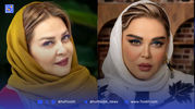 اولین عمل زیبایی بهاره رهنما؛ تغییر زاویه فک و چهره جدید بازیگر سرشناس