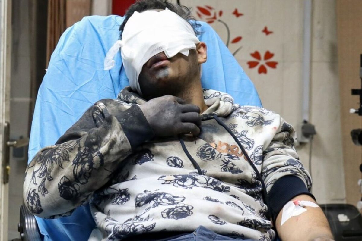 چهارشنبه سوری شروع نشده ۵ قربانی گرفت؛ ۱۵ نفر قطع عضو شدند