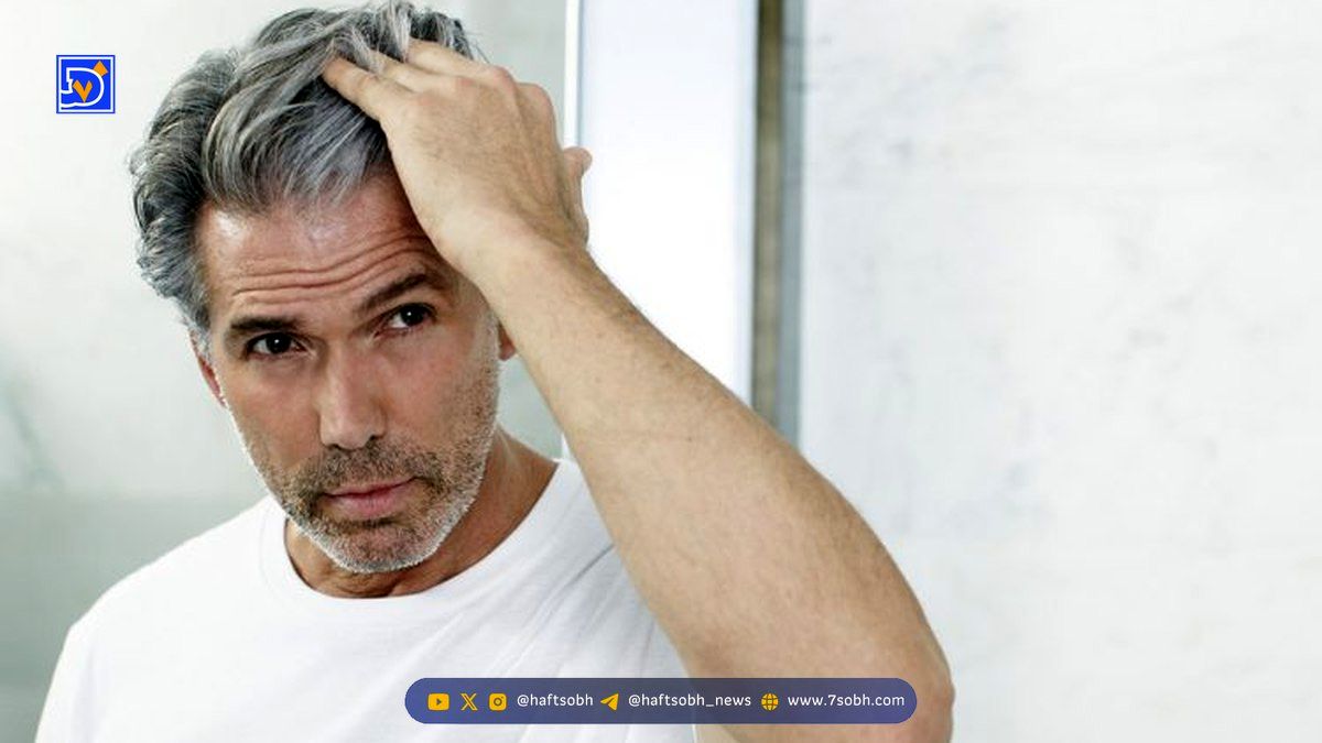 بهترین روشهای مقابله با سفیدی زودرس موها