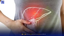 از کبدت محافظت کن؛ همه چیز درباره کبد چرب و راه‌های پیشگیری