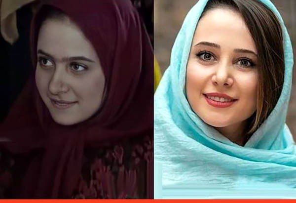 الناز حبیبی قبل و بعد عمل