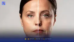 ژلاتین یا کلاژن‌‌‌ کدام برای سلامتی‌ و پوست بهتر است؟