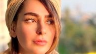 فیلم  تمام جراحی‌های زیبایی سمانه پاکدل از زبان خودش
