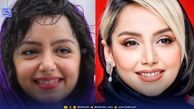 تغییرات چهره نازنین بیاتی از گذشته تا امروز
