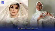 ویدئویی از آماده‌سازی پوست متین ستوده پیش از جشن عروسی؛ تزریق ژل و کارهای زیبایی