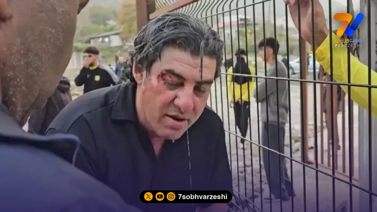 سراج: چنین جهنمی در عمرم ندیده بودم!