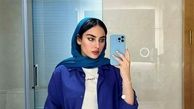 ترلان پروانه با چهره‌ای متفاوت؛ او این‌بار چه کرده است؟
