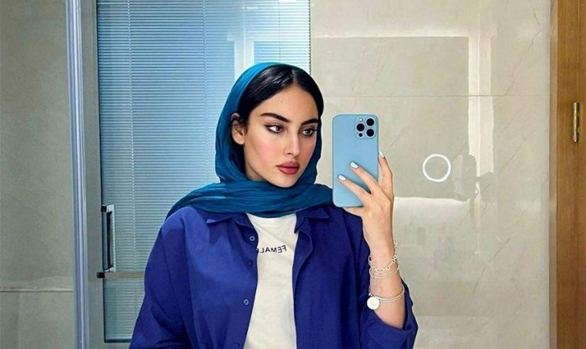 ترلان پروانه با چهرهای متفاوت؛ او اینبار چه کرده است؟