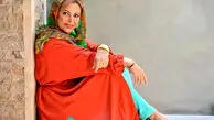 عکس| کمند امیرسلیمانی ۱۷ ساله قبل از جراحی بینی