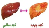پنج علامت مهم ابتلا به کبد چرب