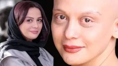 بیوگرافی تلخ مارال فرجاد؛ از سرطان تا سیمرغ بلورین جشنواره فجر