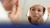افزایش مشکلات پوستی در روزهای بحران