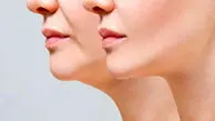 چه شوینده ای برای پوستم مناسبه ؟
