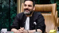 احسان علیخانی قبل و بعد از کاشت مو