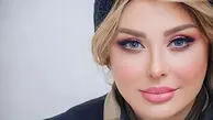 تغییر چهره جنجالی نیوشا ضیغمی دوباره خبرساز شد | ببینیدش، دیگه نمی‌شناسیدش!