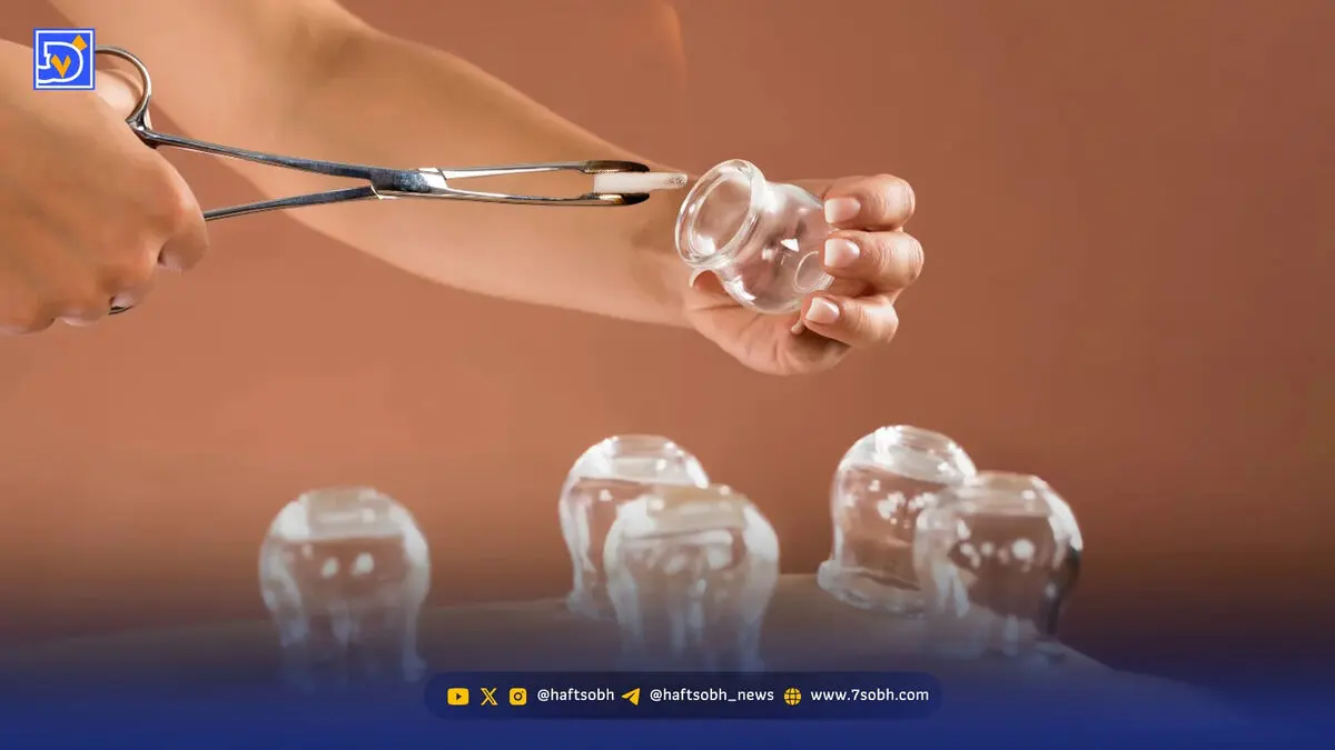 حجامت دوباره اوج گرفت