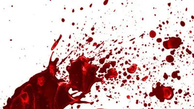 قطع شدن دست مرد تهرانی با ضربه قمه در مشیریه / پای 2 زن در میان بود 