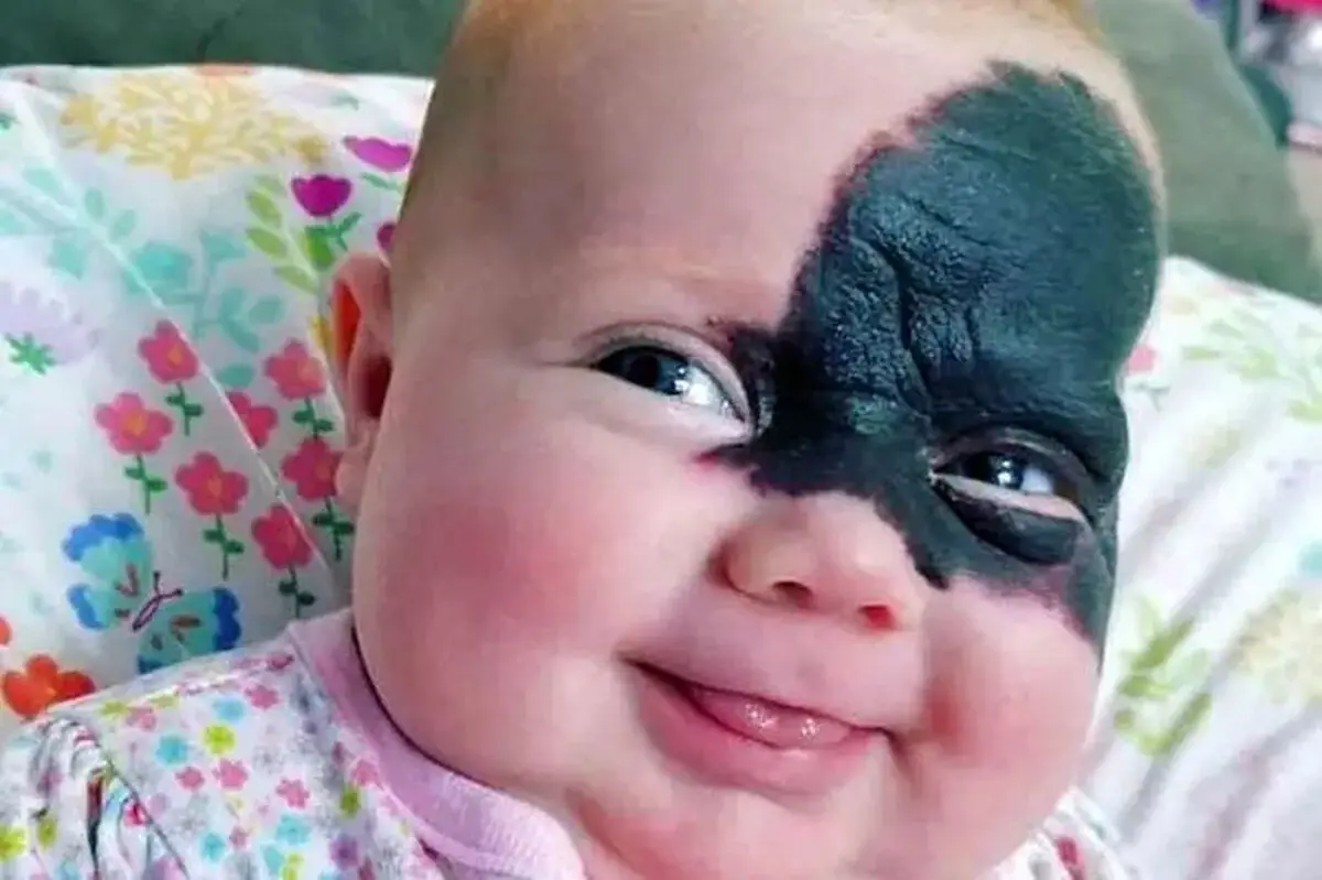 صورت این دختر کوچولوی زیبا تا جوانی کاملا تغییر می کند + عکس نوزادی اش