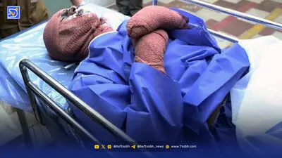 انتقام اسیدی مرد قهوه‌چی از همکاران همسرش 