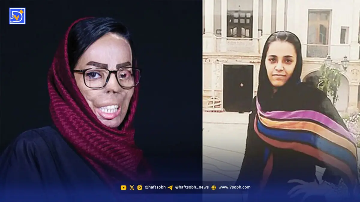 داغ اسید روی صورت خواهرشوهر