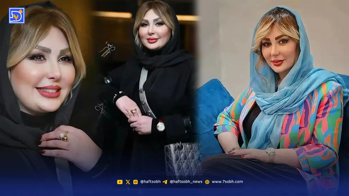نیوشا ضیغمی از تجربه بوتاکس و نگاهش به جذابیت مردان گفت