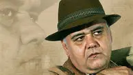 علت فوت اکبر عبدی مشخص شد!