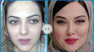 چهره عملی لیلا اوتادی، صداوسیما را به دردسر انداخت! + عکس