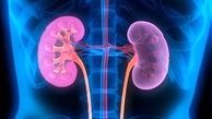 بهترین رژیم غذایی برای بیماری کلیوی 