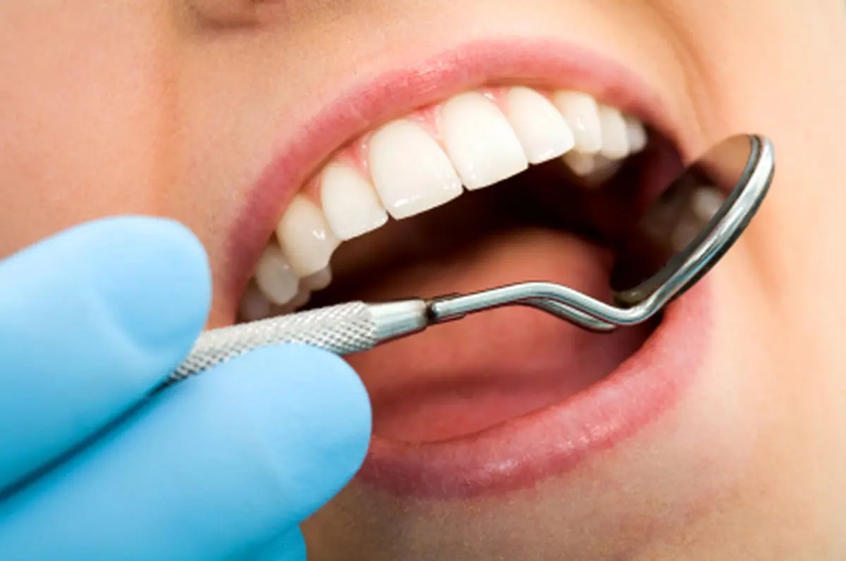 چگونه از زرد شدن دندان ها جلوگیری کنیم؟